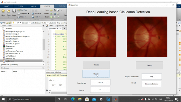 GlaucomaDetection using CNN and Matlab 3