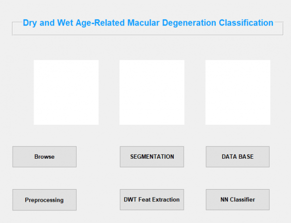 Dry and Wet Age Related Macular Degeneration Classification using OCT Images and Deep Learning 1
