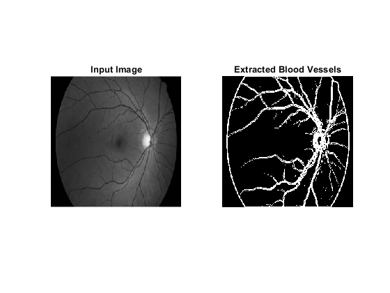 Dry and Wet Age Related Macular Degeneration Classification using OCT Images and Deep Learning 4