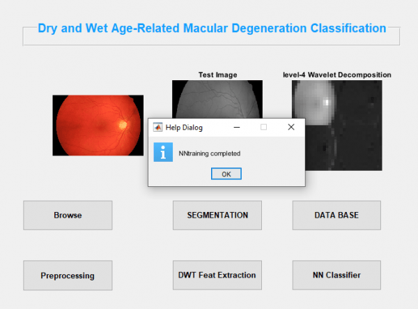 Dry and Wet Age Related Macular Degeneration Classification using OCT Images and Deep Learning 6