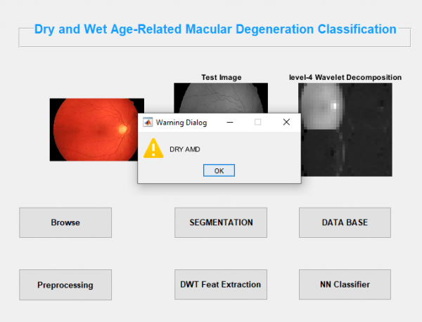 Dry and Wet Age Related Macular Degeneration Classification using OCT Images and Deep Learning 7