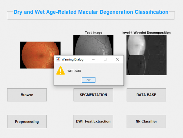 Dry and Wet Age Related Macular Degeneration Classification using OCT Images and Deep Learning 8