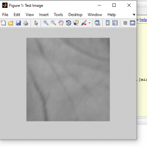 Palm Vein Pattern Recognition using Matlab 2