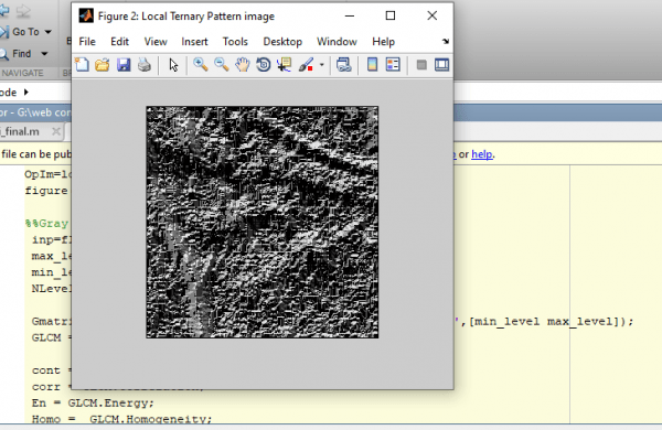 Palm Vein Pattern Recognition using Matlab 3