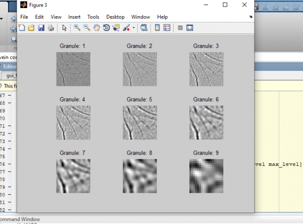 Palm Vein Pattern Recognition using Matlab 4