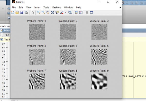 Palm Vein Pattern Recognition using Matlab 5