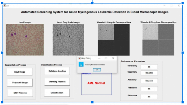 Blood Cell Classification In MicroScopic Images4