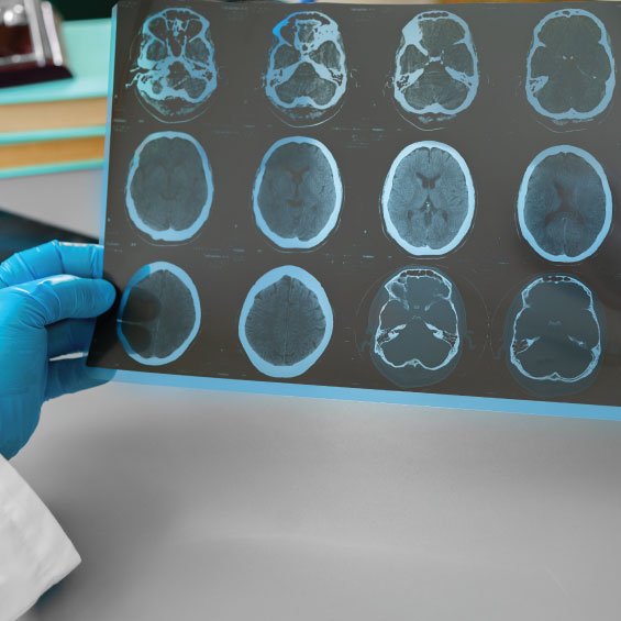Brain Tumor Segmentation Using Priobabilty Neural Network