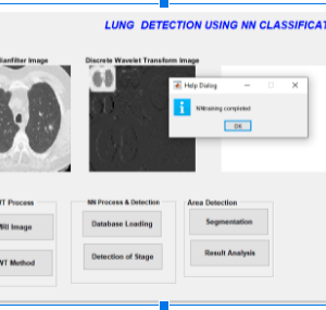 Lung Cancer detection Using Matlab 3