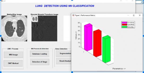 Lung Cancer detection Using Matlab 5