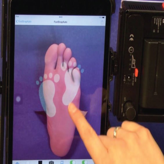 foot ulceration detection and monitoring raspberry pi