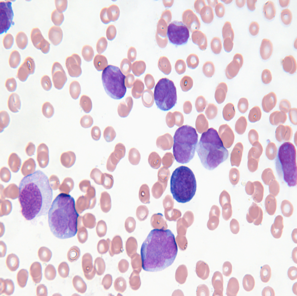 Leukocytes Classification and Segmentation in Microscopic Blood Smear