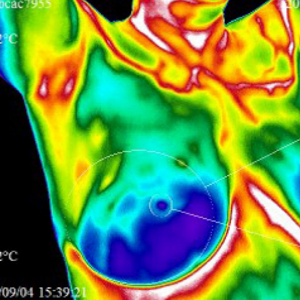 Matlab Code for Thyroid detection using thermal images