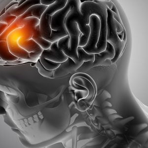 AI based Brain Tumour Detection using SWT based Image Fusion